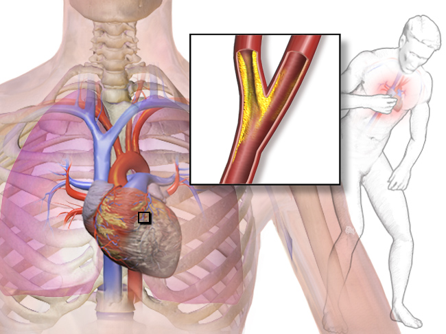 Top 8 Nutrients That Improve Cardiac Function