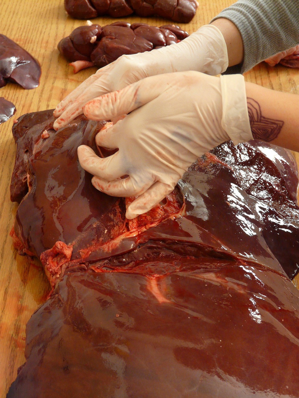 7 Famous Foods Packed With Iron and B12