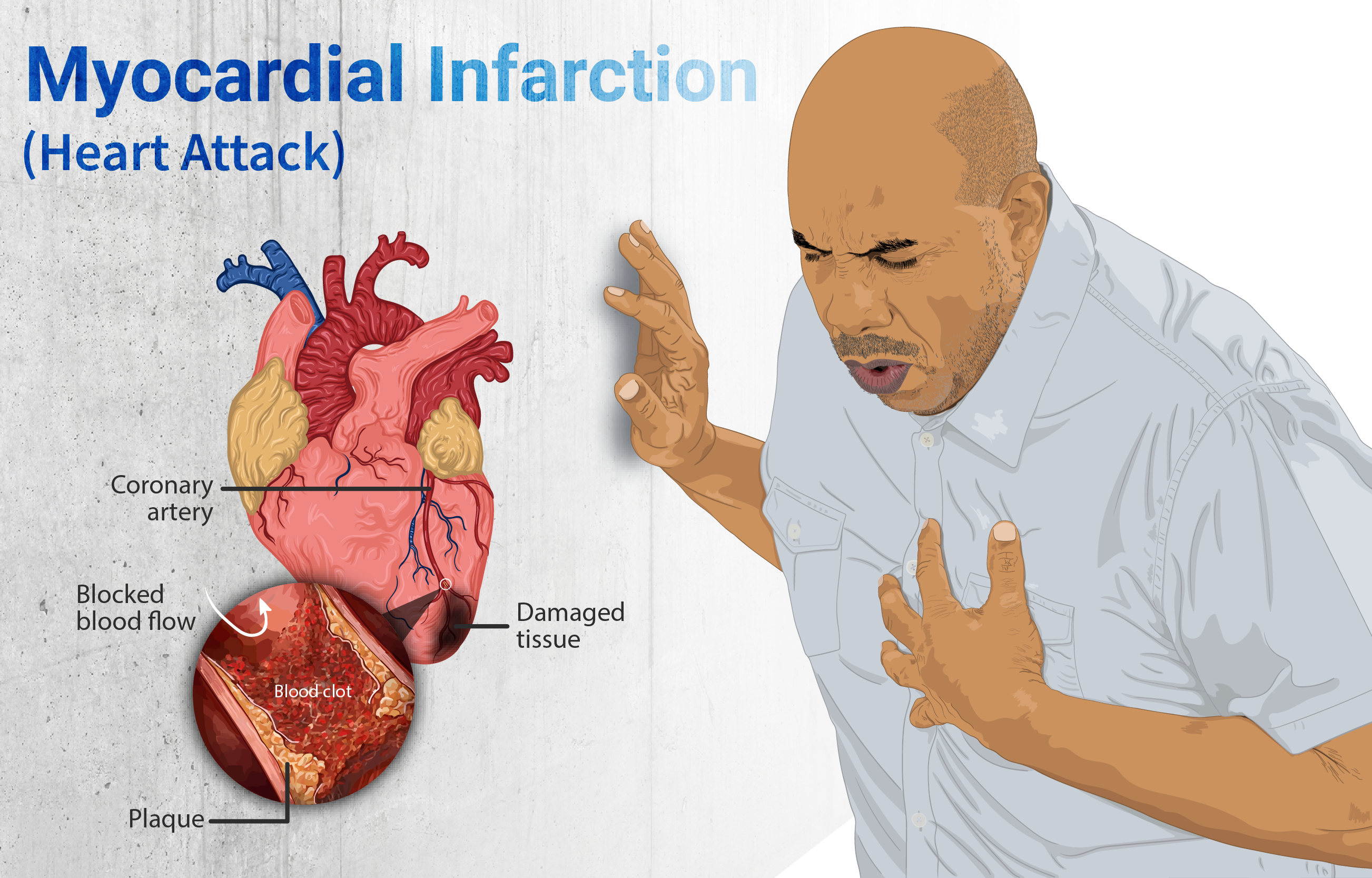 Your Body on Sugar: 10 Red Flags and How to Reverse the Damage