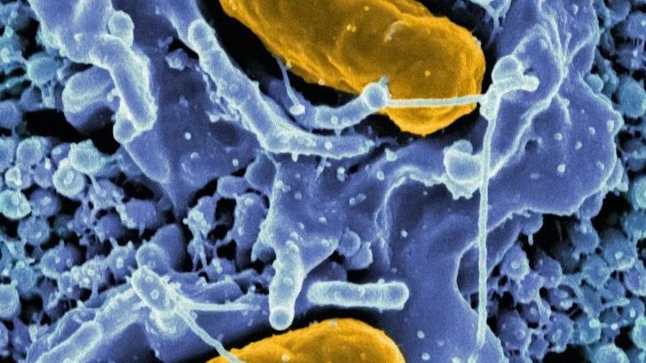 What To Know Before You Start Canning Water