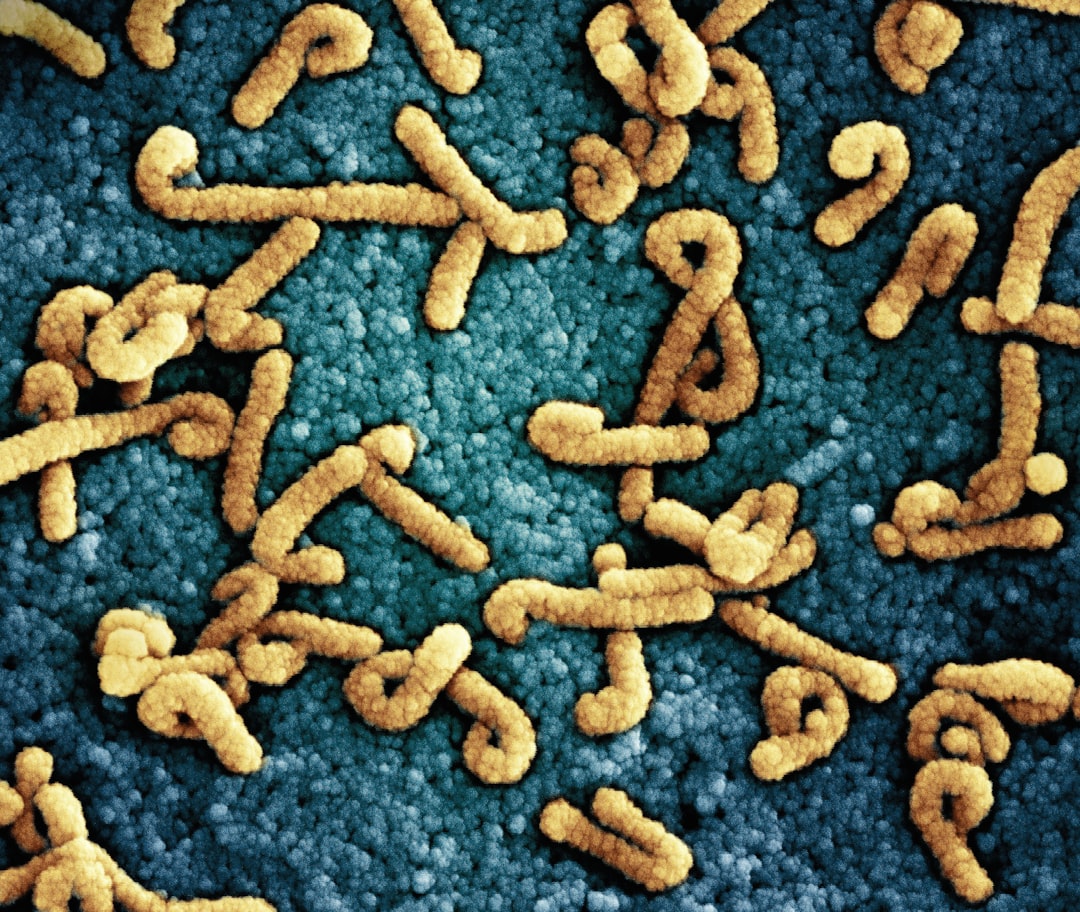 Denmark solves 4 of 10 recent Listeria outbreaks