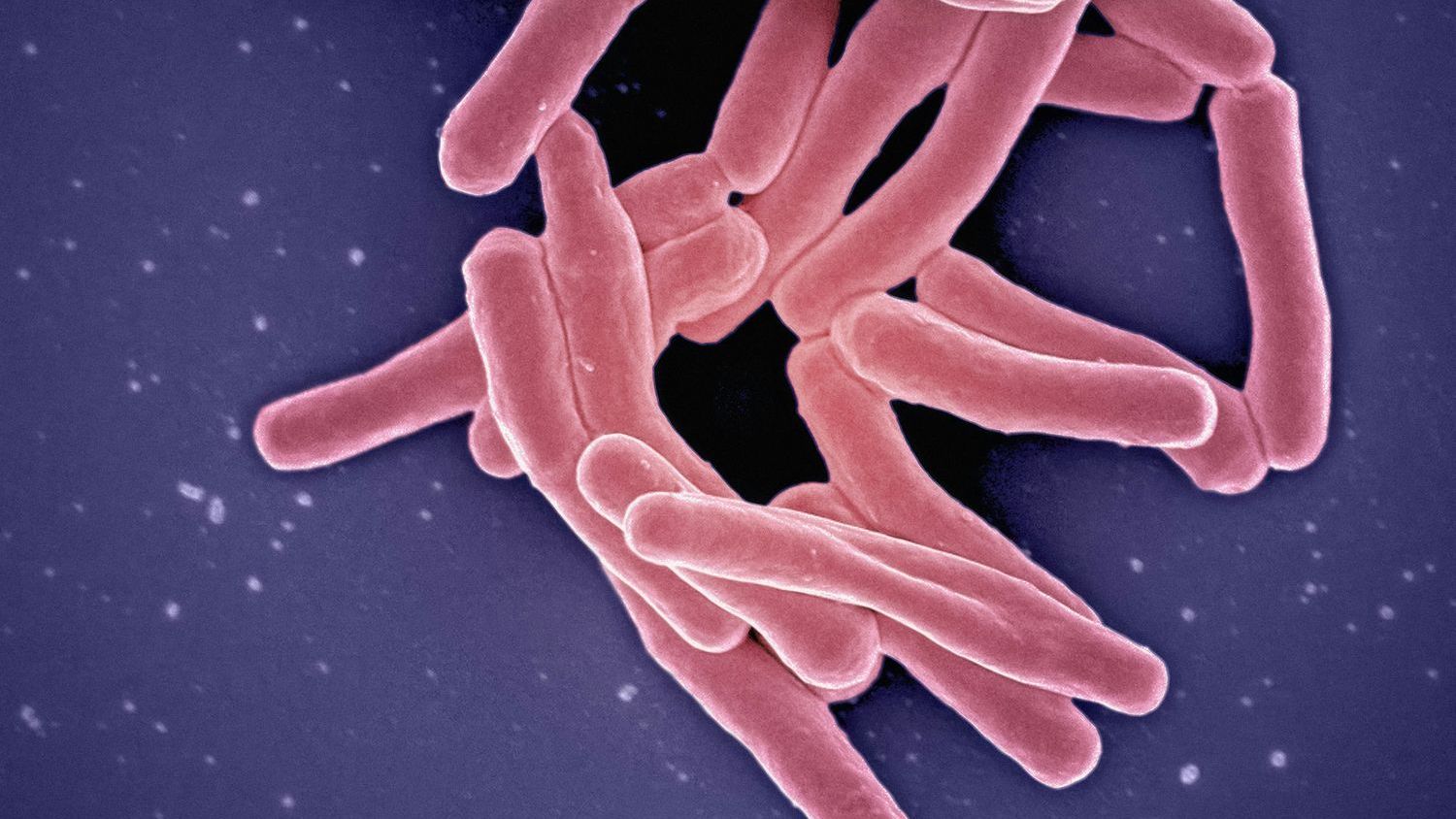 Children sick in Danish Salmonella outbreak