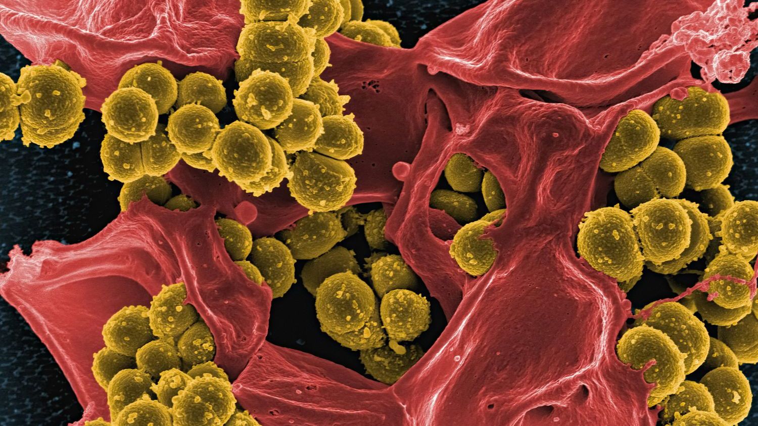 This Gut Factor Predicts How Strongly You React to Stress (M)
