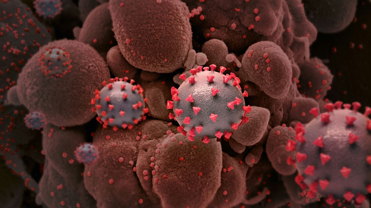 Norovirus sickens hundreds in Sweden