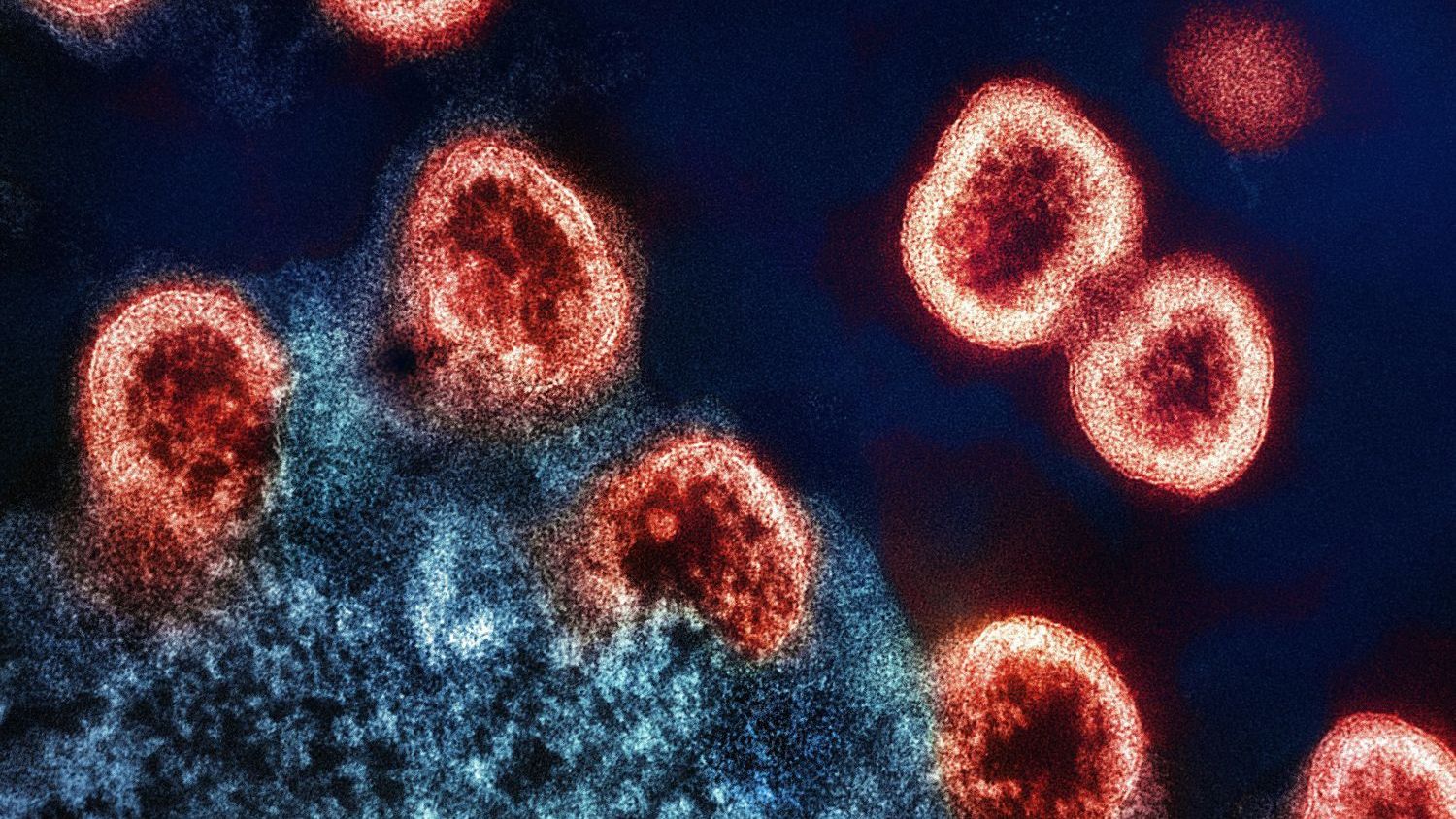 Cruise ship hantavirus outbreak highlights persistent food safety risks from rodents
