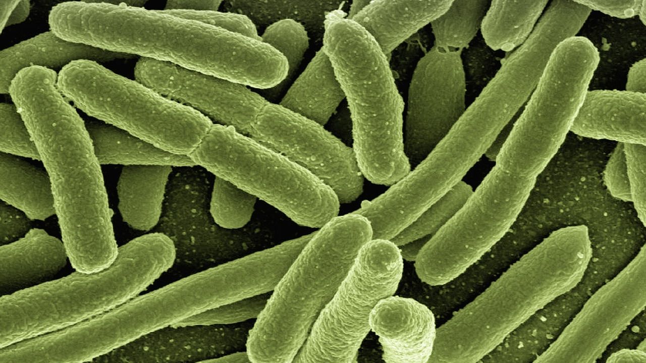 Test results show headcheese is contaminated with outbreak strain of Listeria